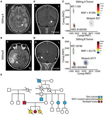 Somatic Mosaicism of IDH1 R132H Predisposes to Anaplastic Astrocytoma: A Case of Two Siblings